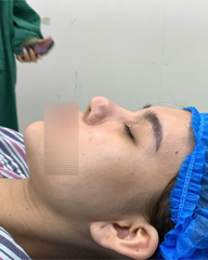 Trước điều trị