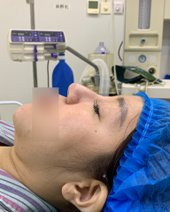 Trước điều trị